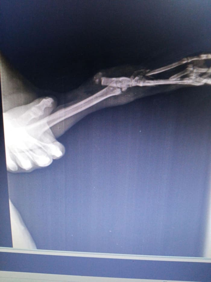 Pauna Akrity on arrival